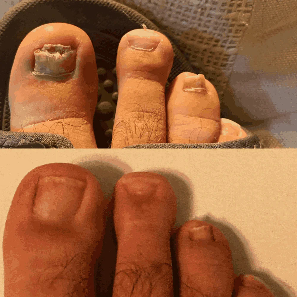Swisscure™ - Your Path to Healthier-Looking Nails .