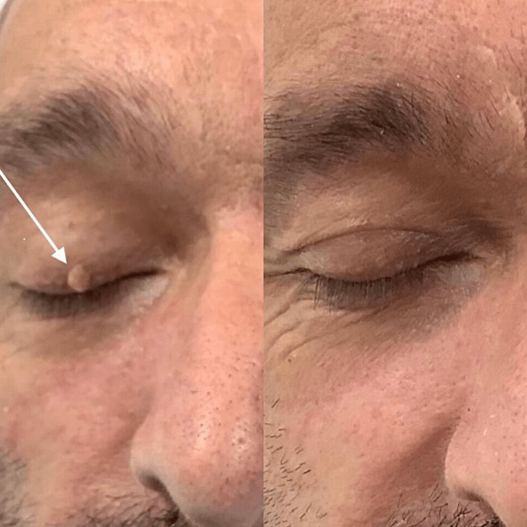 Swisscure™ – Your Path to Clearer, Blemish-Free Skin